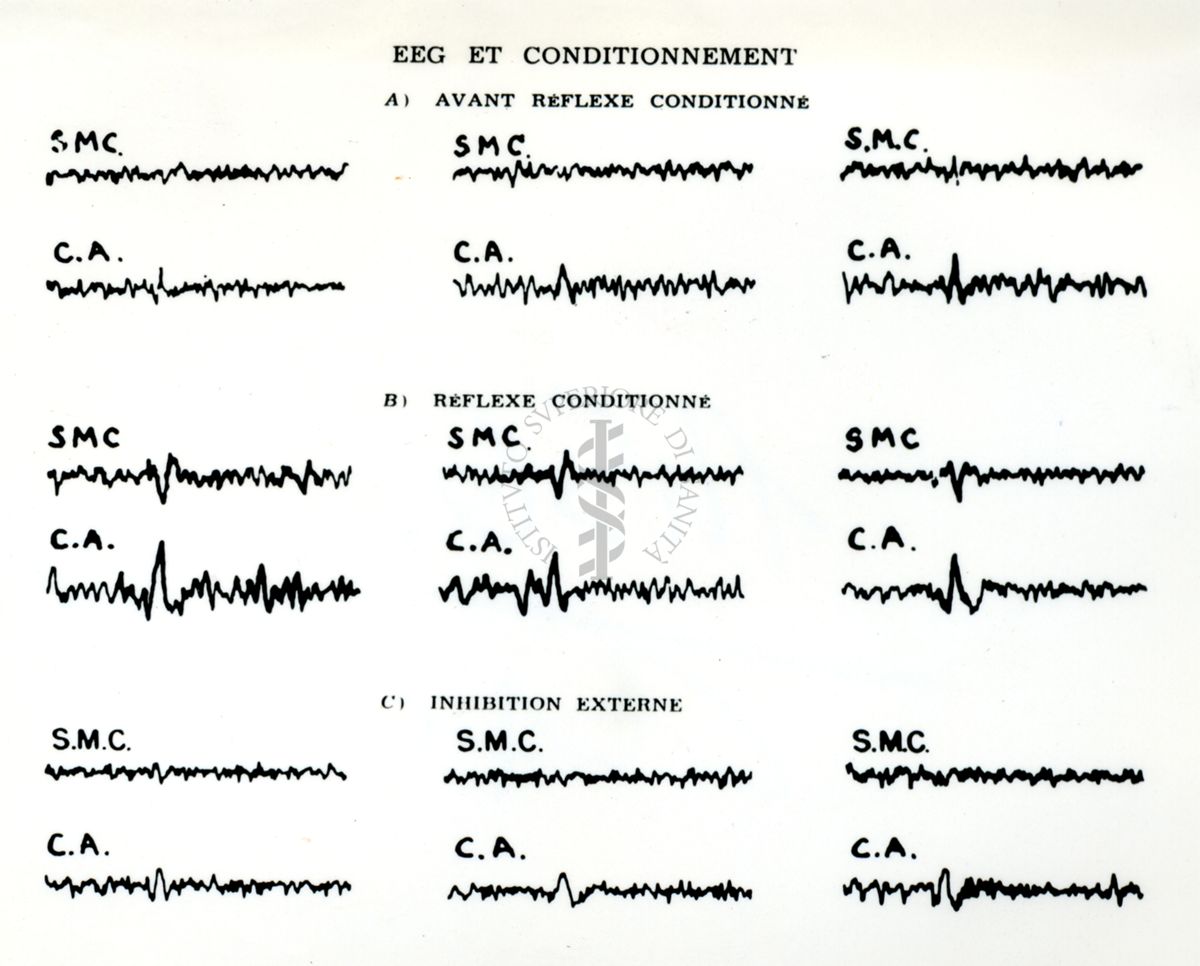 Tracciati elettroncefalografici di coniglio