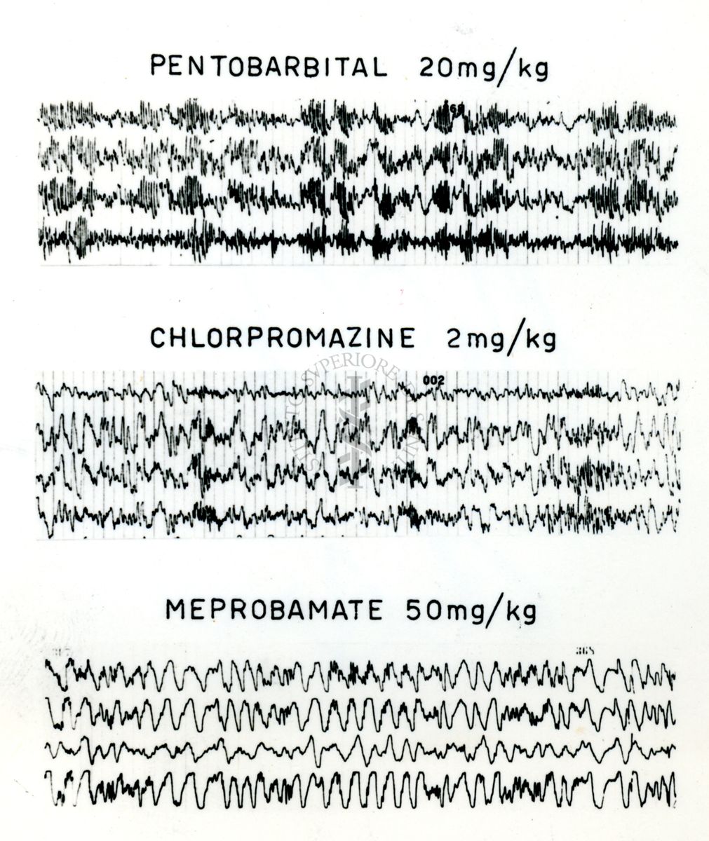 Tracciati elettroncefalografici di coniglio