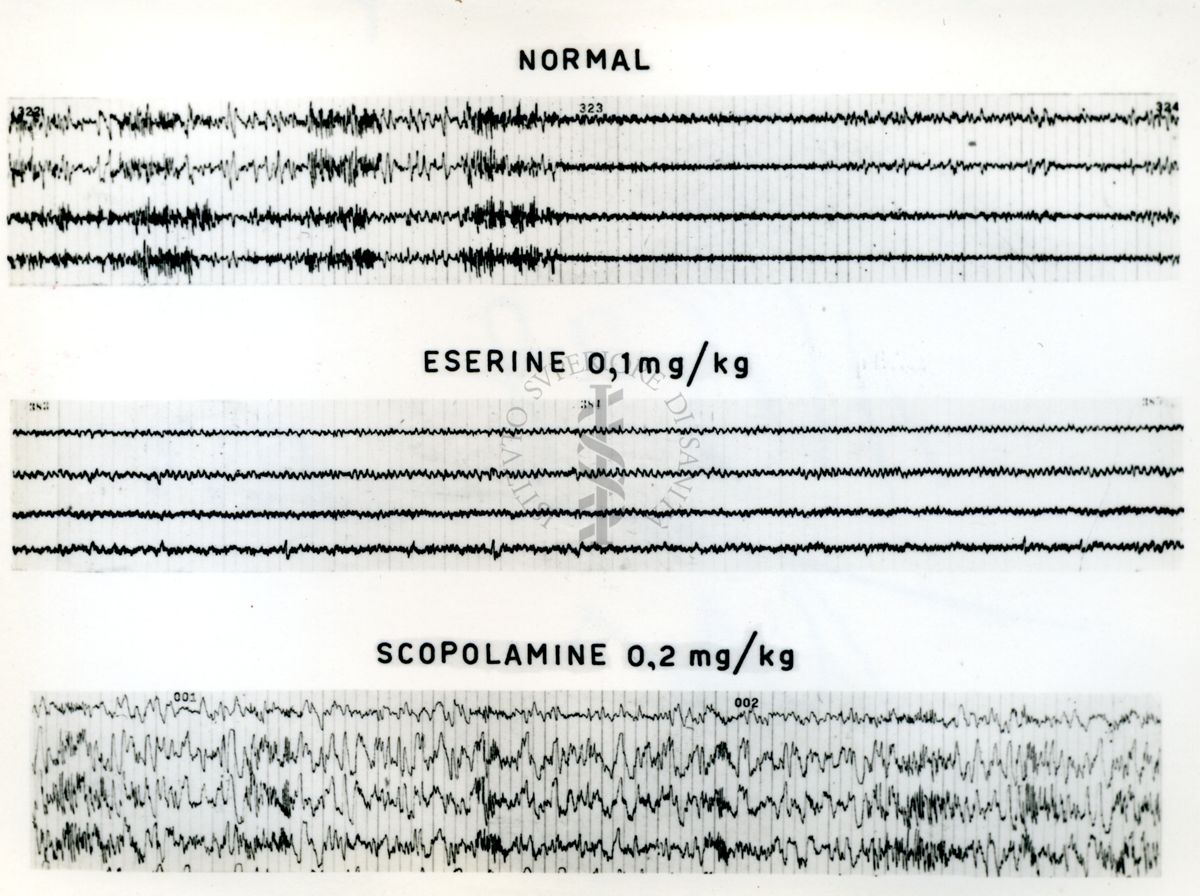 Tracciati elettroncefalografici di coniglio
