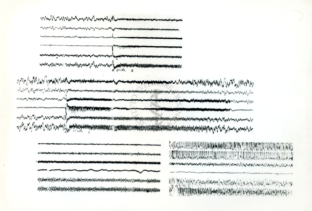 Tracciati elettroncefalografici di coniglio