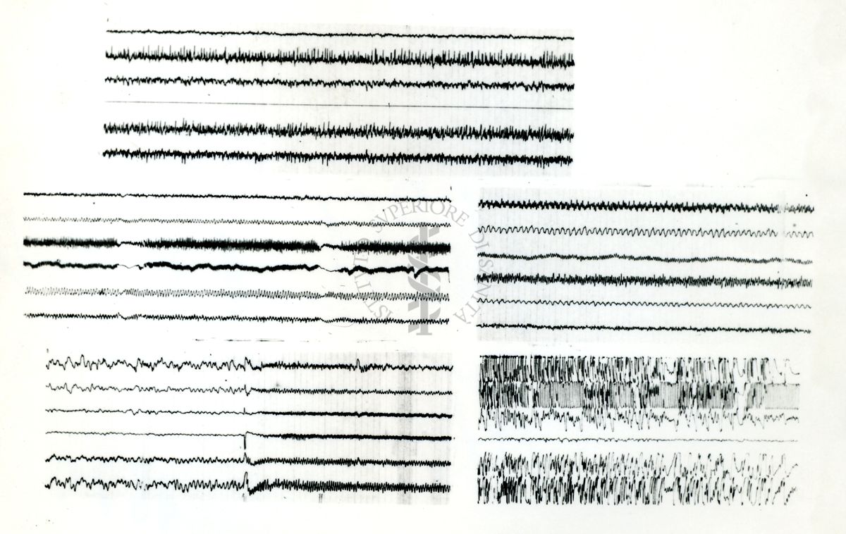 Tracciati elettroncefalografici di coniglio