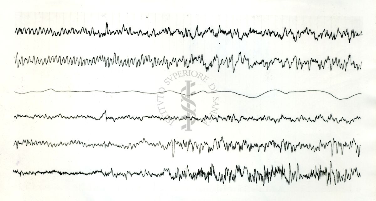 Tracciati elettroncefalografici di coniglio