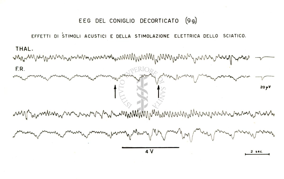 Tracciati elettroencefalografici di coniglio