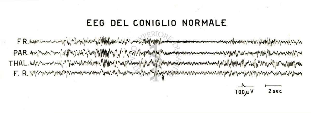 Tracciati elettroencefalografici di coniglio