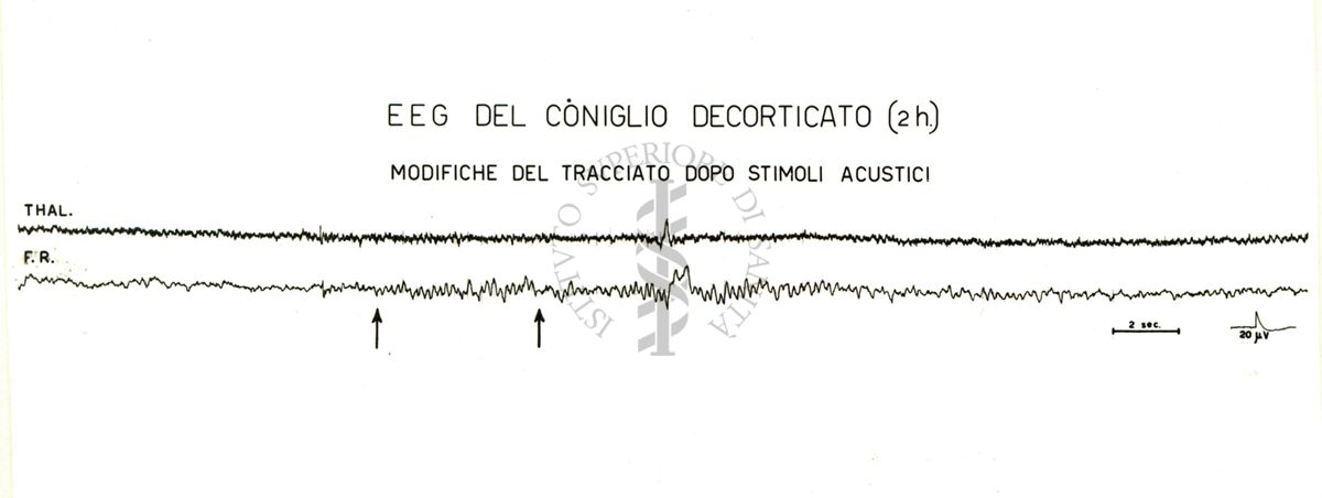 Tracciati elettroencefalografici di coniglio