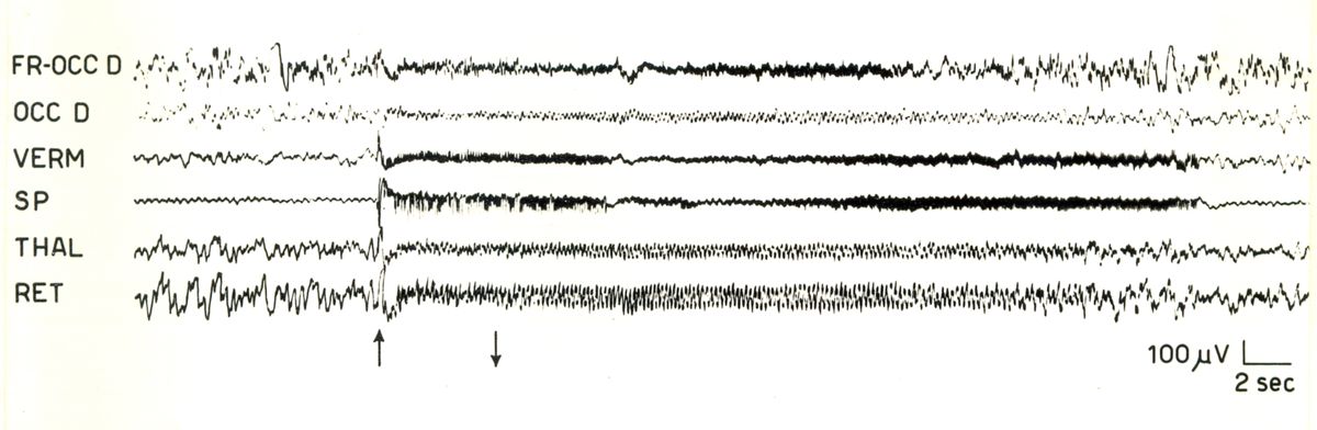 Elettroencefalogrammi di coniglio