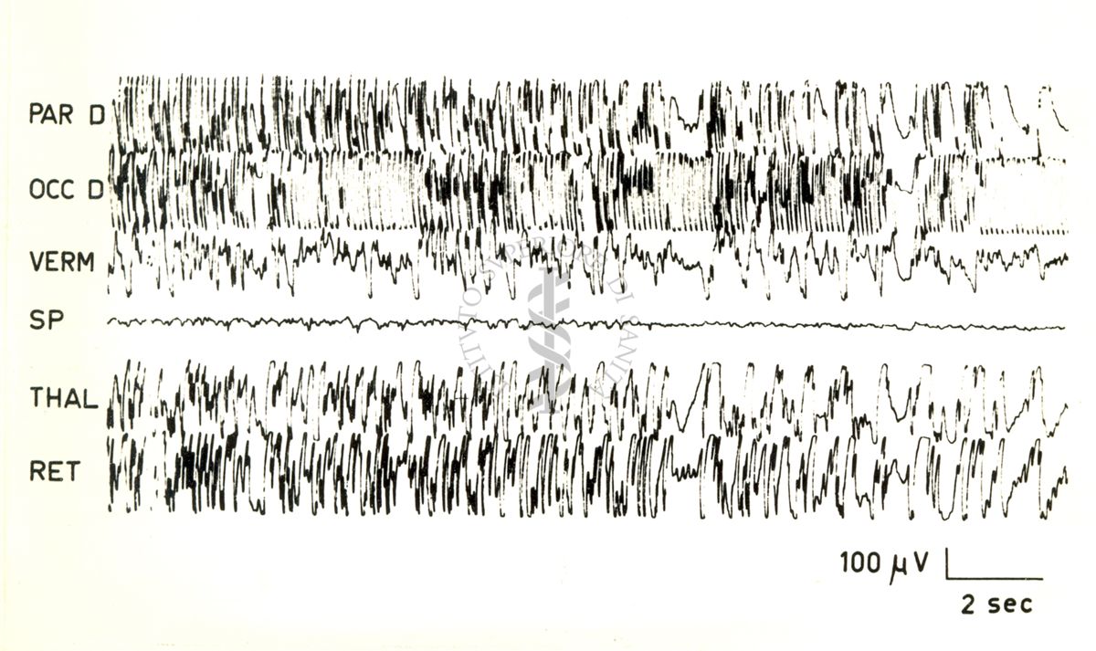 Elettroencefalogrammi di coniglio