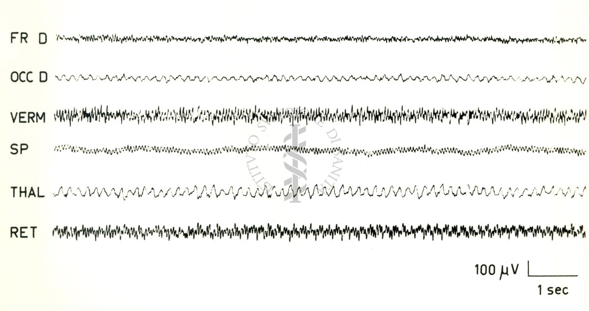 Elettroencefalogrammi di coniglio