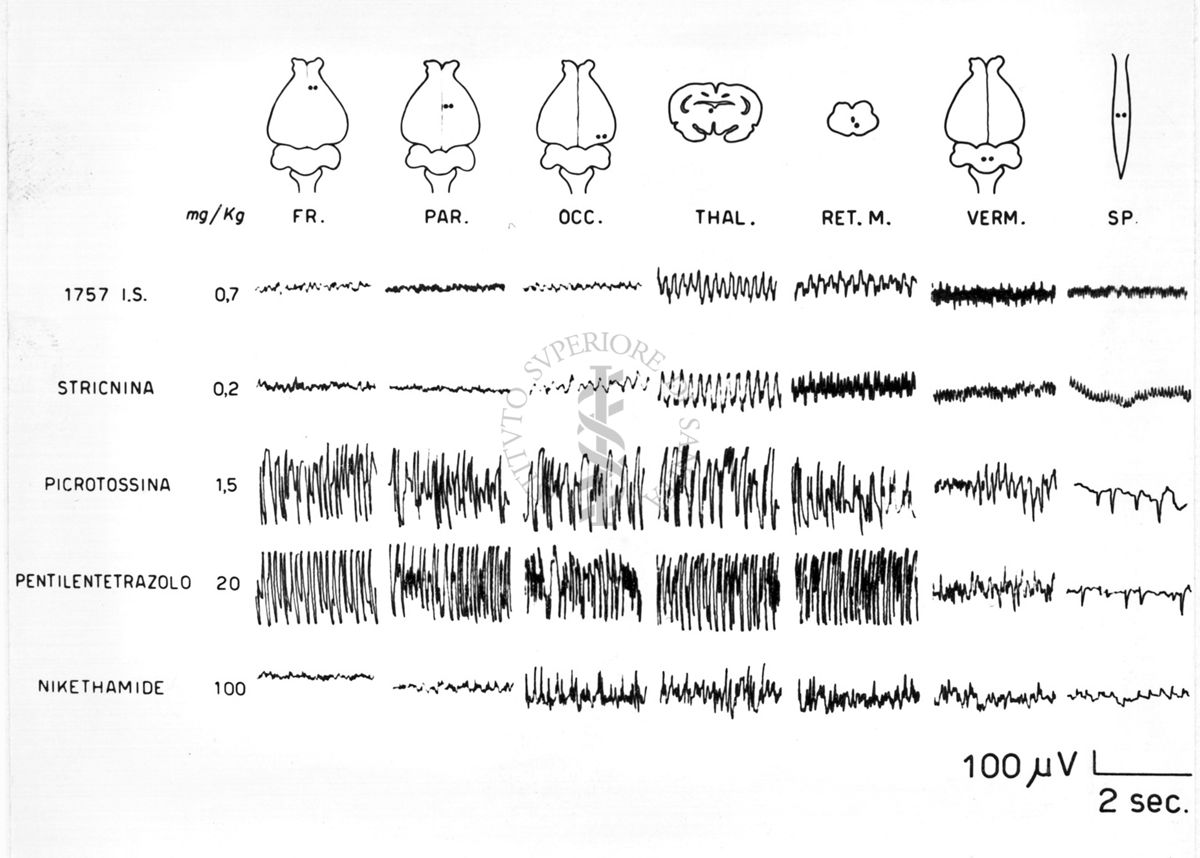 Elettroencefalogrammi di coniglio