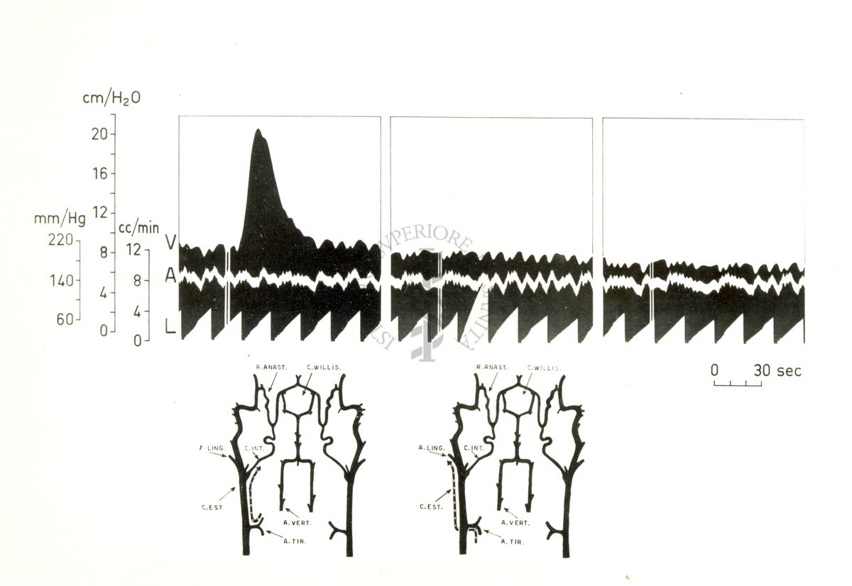 Circolo cerebrale - iniezioni intraarteriose