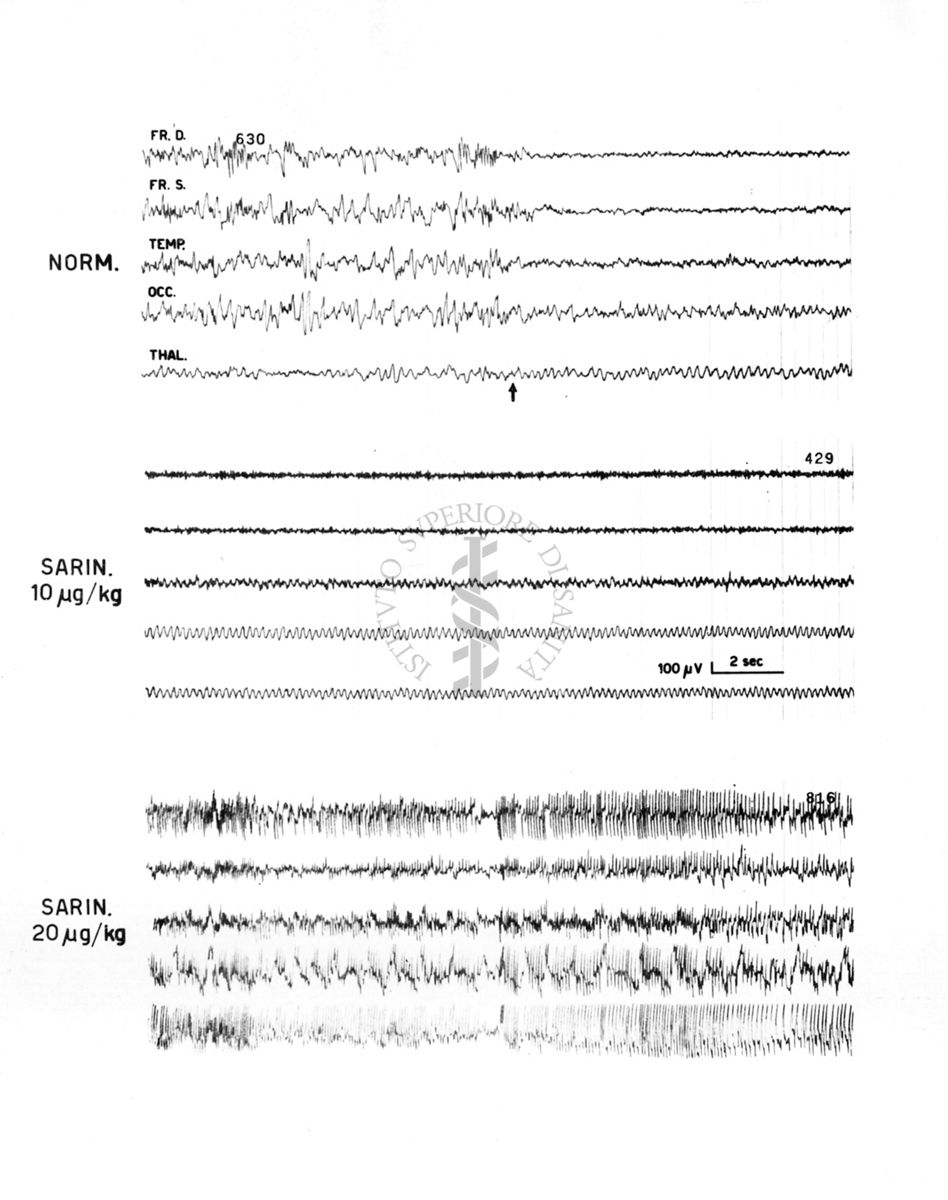 Sarin Pam - Azione elettroencefalografica