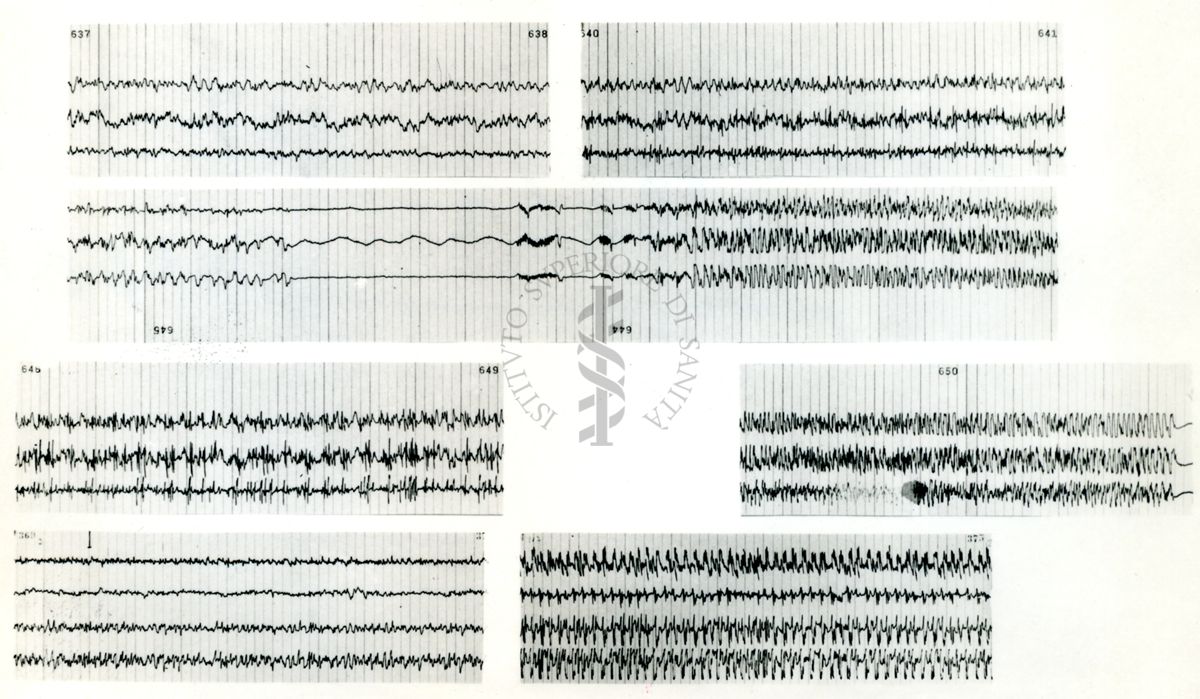 Rapporti tra circolazione cerebrale ed elettroncefalografia