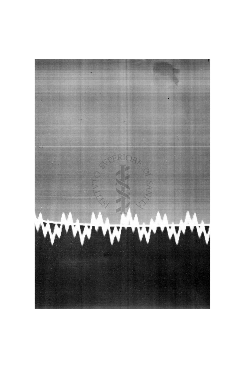 Azione vascolare cerebrale della stricnina