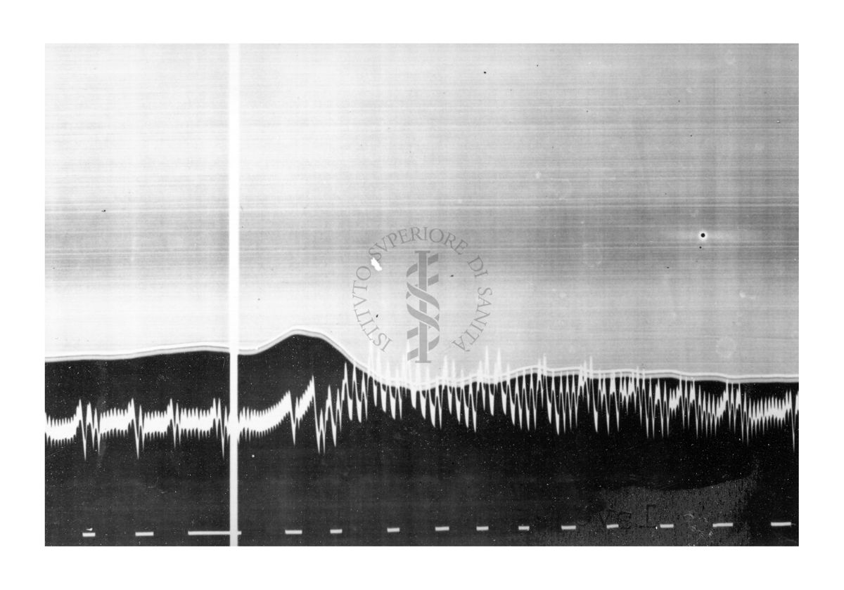 Azione vascolare cerebrale della stricnina