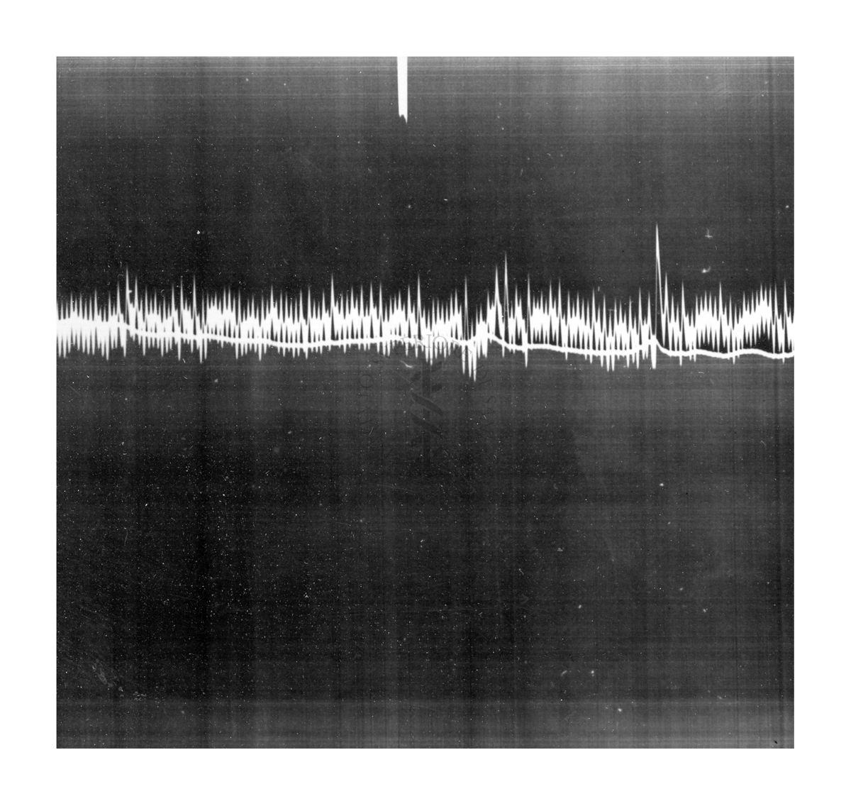 Azione vascolare cerebrale della stricnina