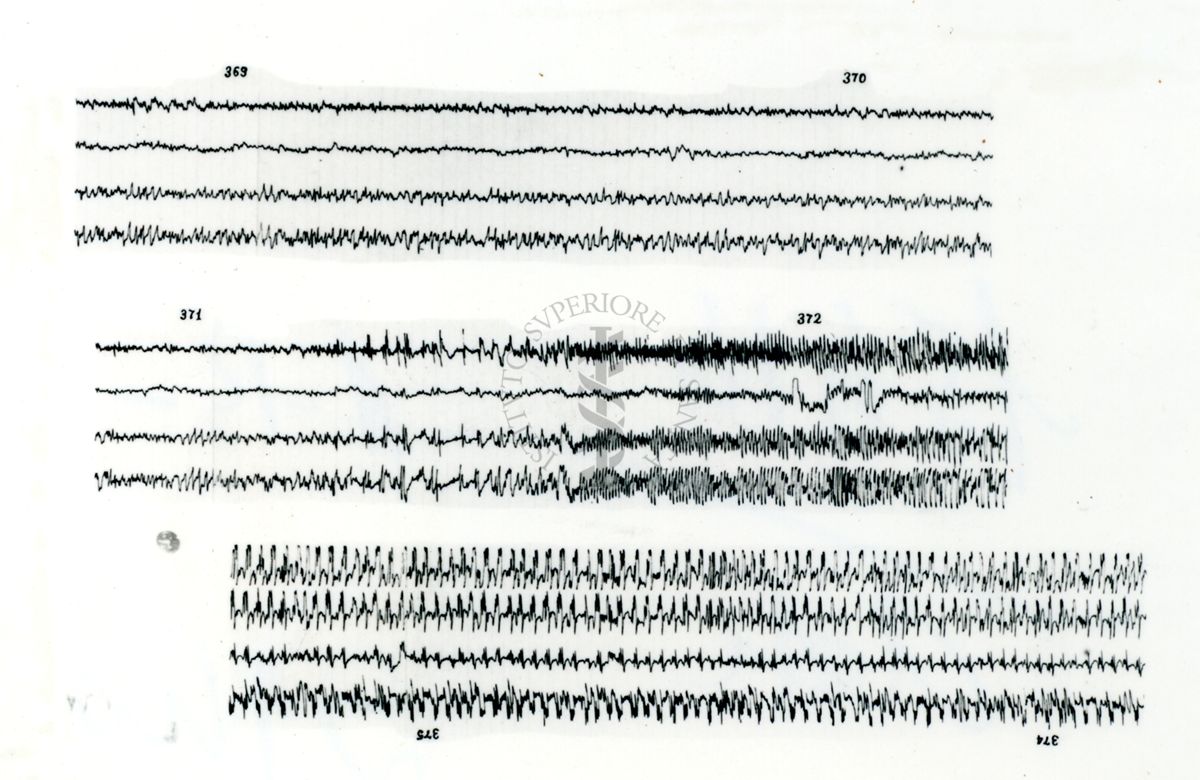 Azione elettroencefalografica della stricnina