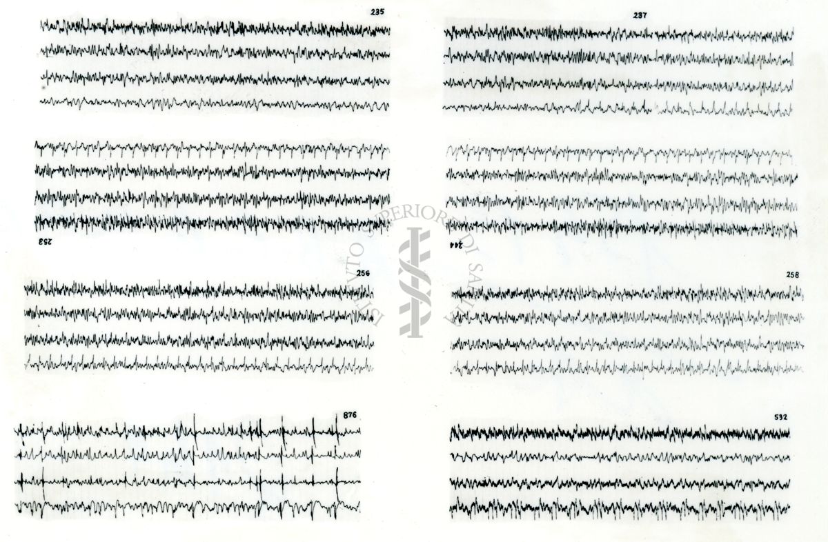 Azione elettroencefalografica della stricnina