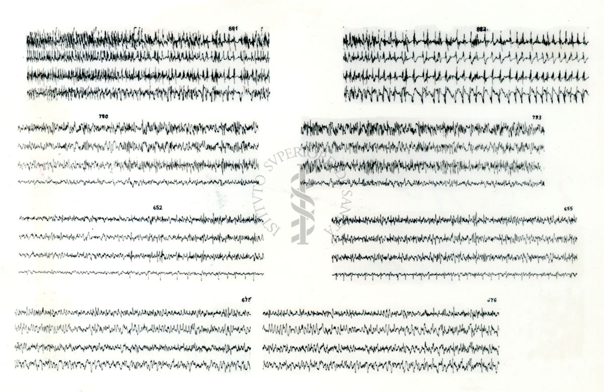 Azione elettroencefalografica della stricnina