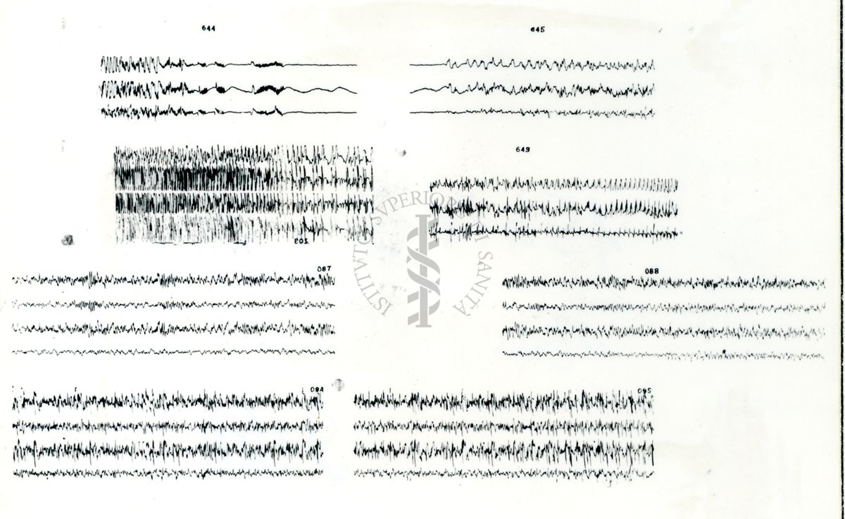 Azione elettroencefalografica della stricnina