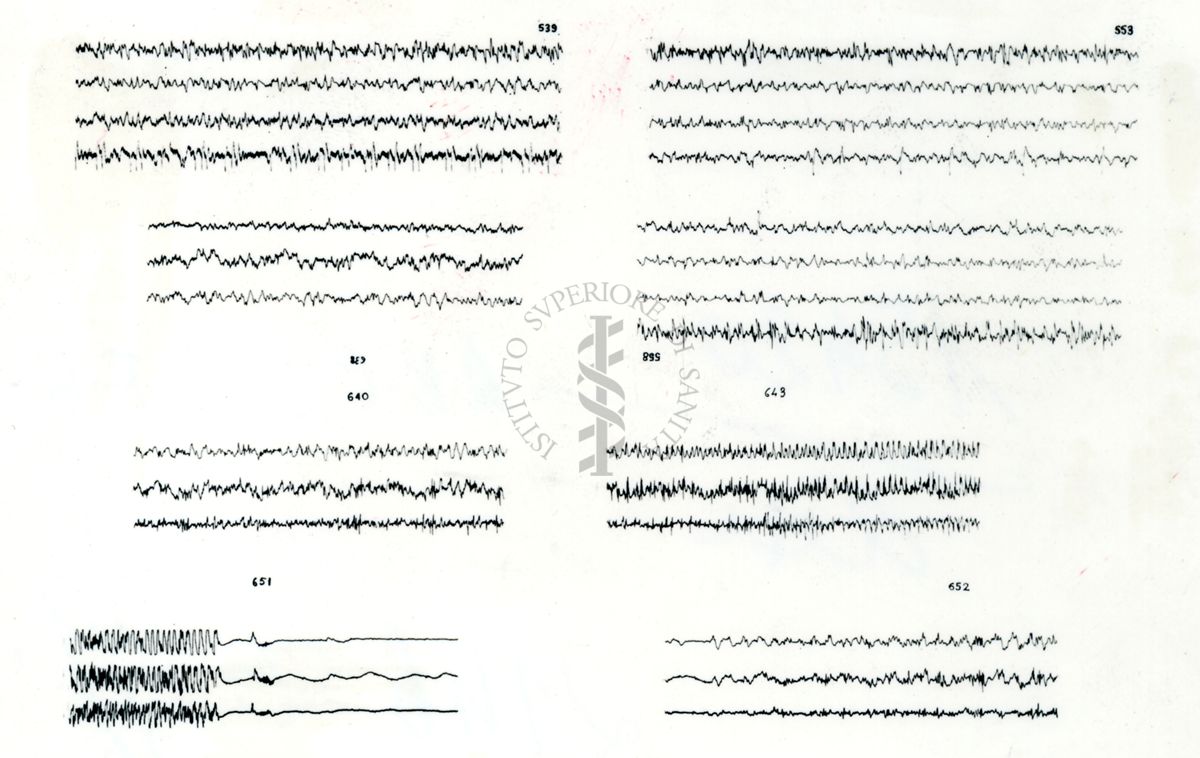 Azione elettroencefalografica della stricnina