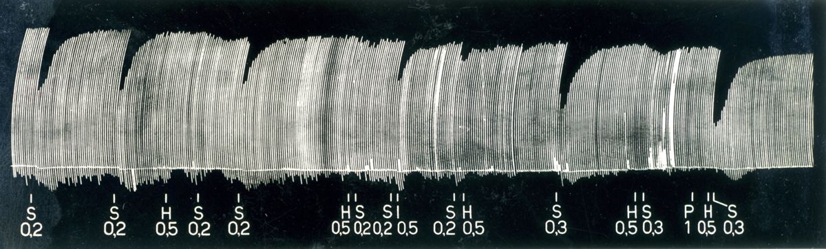 Azione dell'istamina sulla trasmissione neuromuscolare in relazione agli effetti di alcuni curari