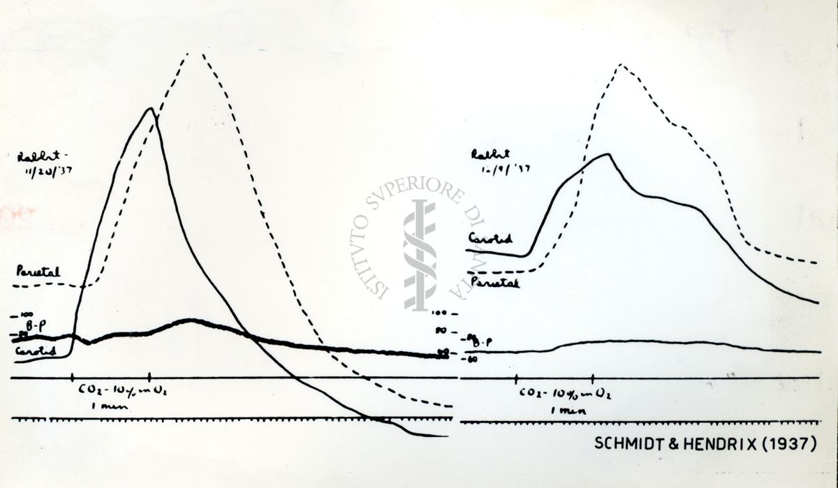 Farmacologia della circolazione cerebrale