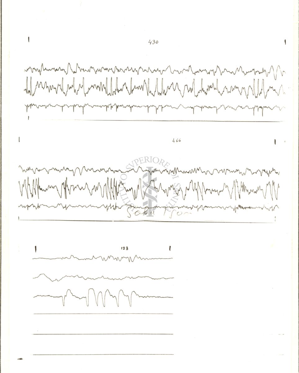 Tracciati elettroencefalografici di coniglio