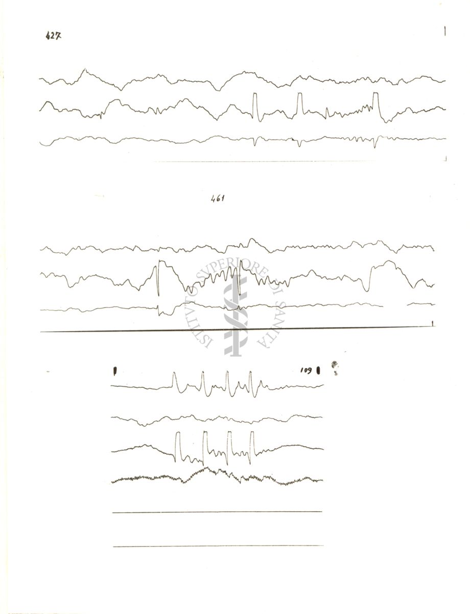 Tracciati elettroencefalografici di coniglio