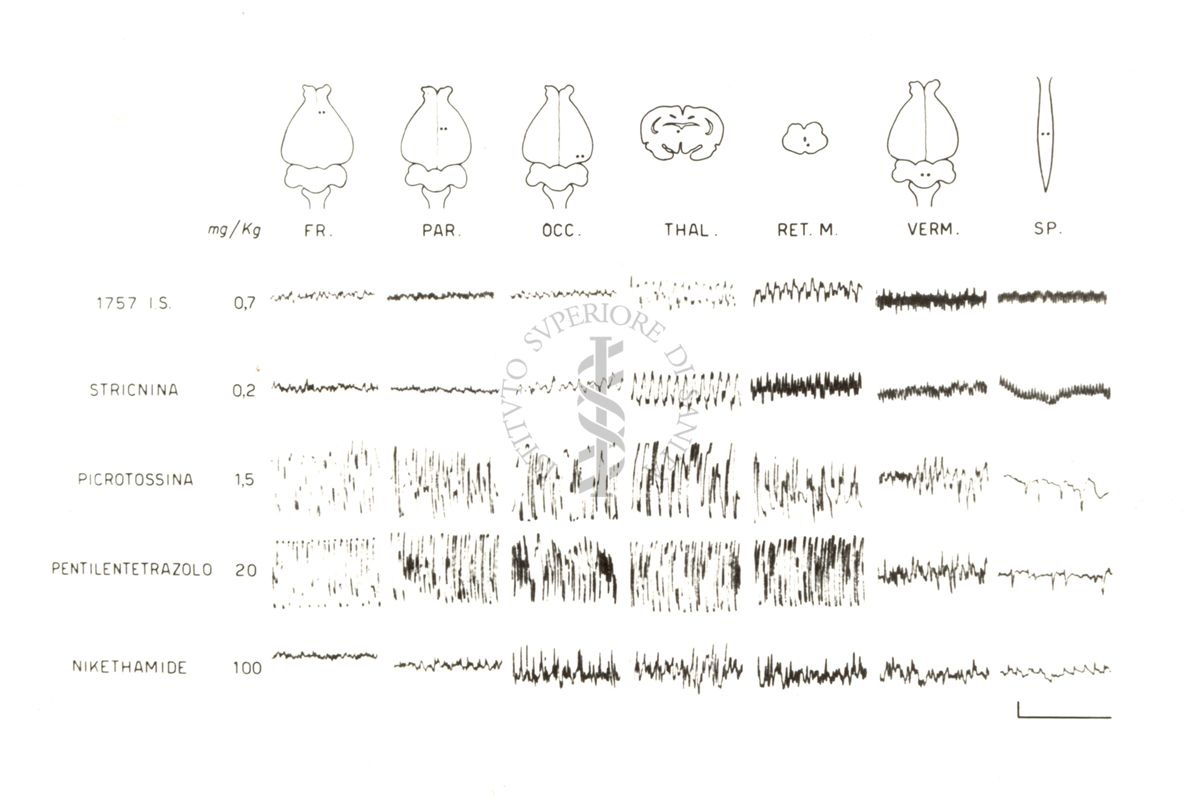 Tracciati elettroencefalografici