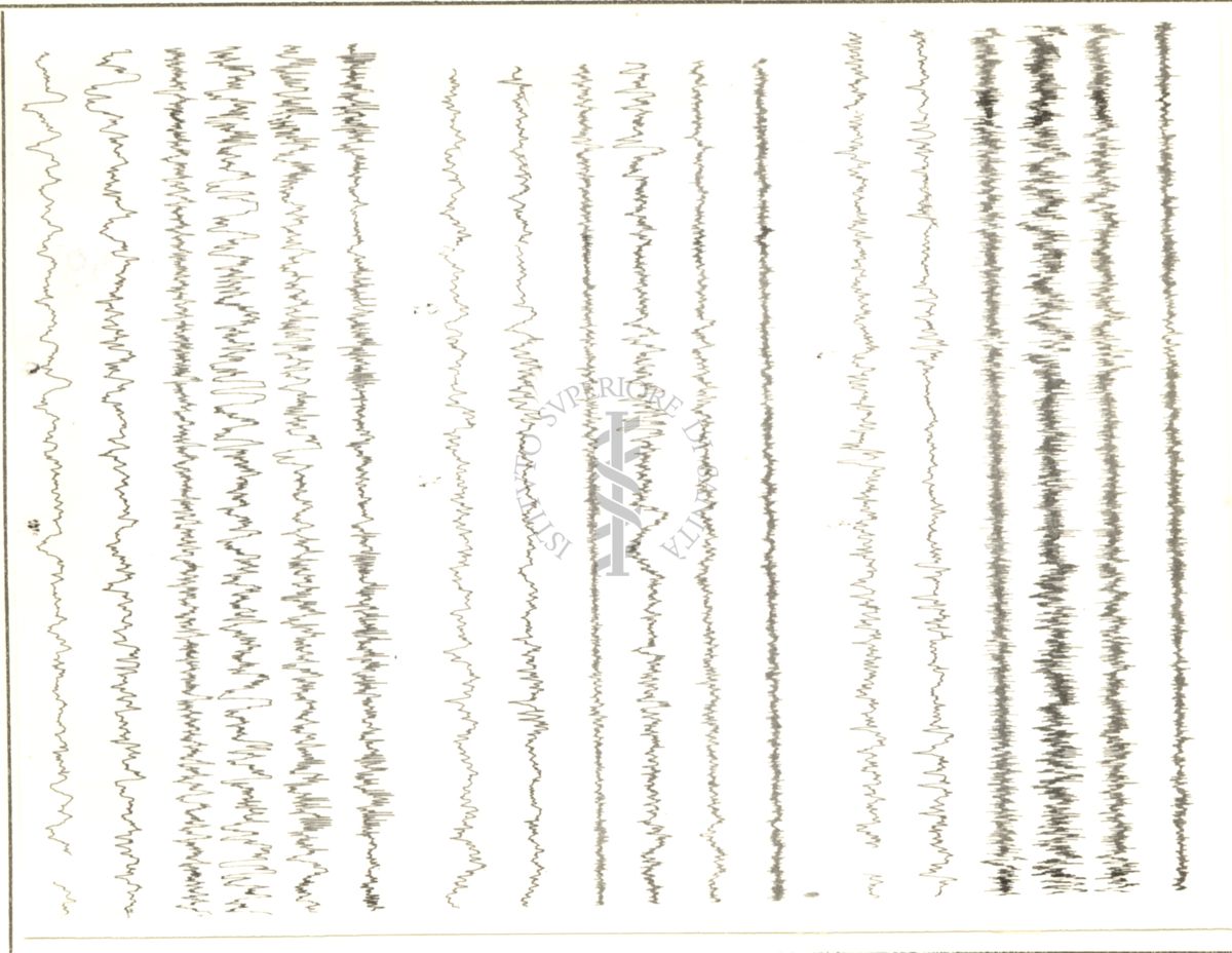 Tracciati elettroencefalografici