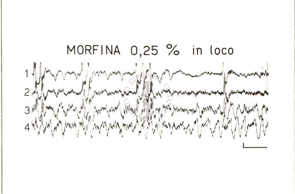 Elettroencefalogrammi di conigli