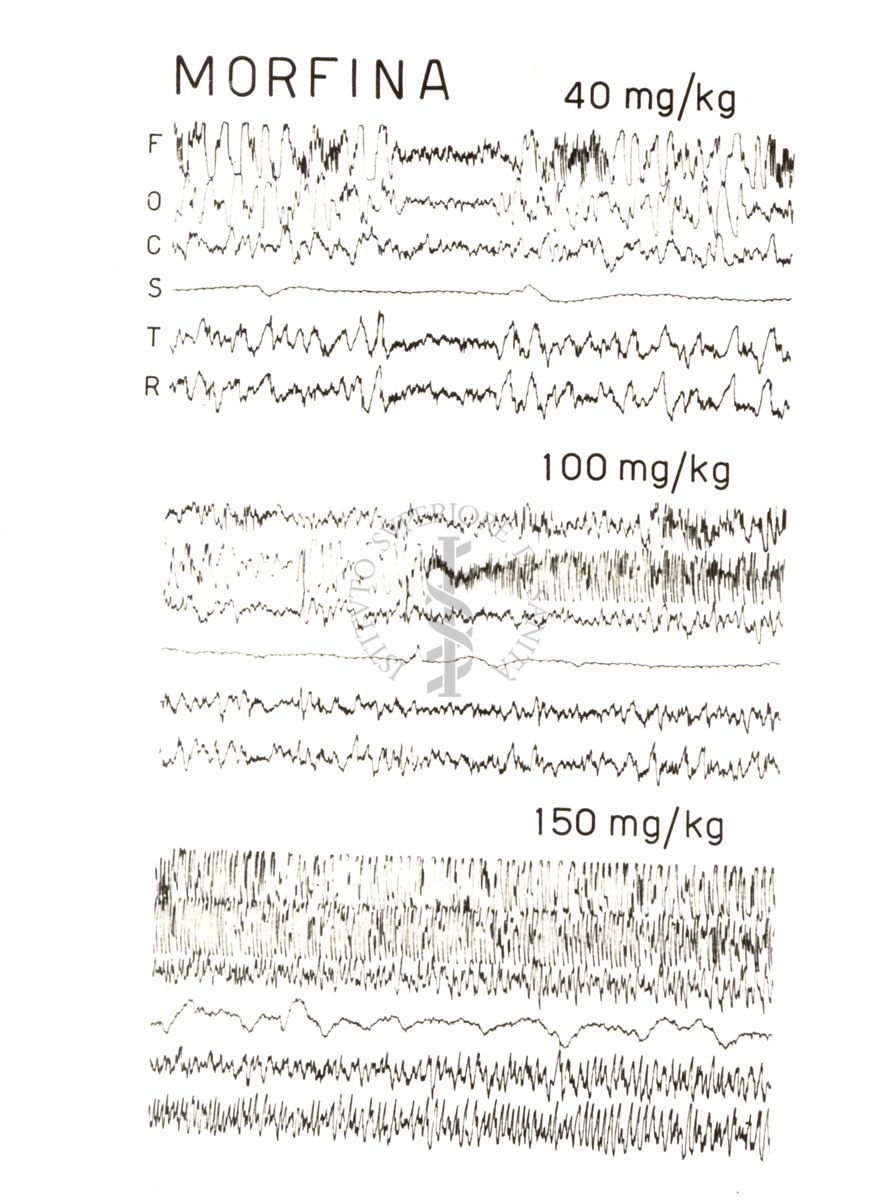 Elettroencefalogrammi di conigli