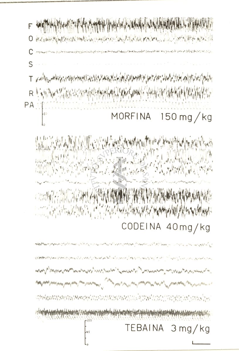 Elettroencefalogrammi di conigli