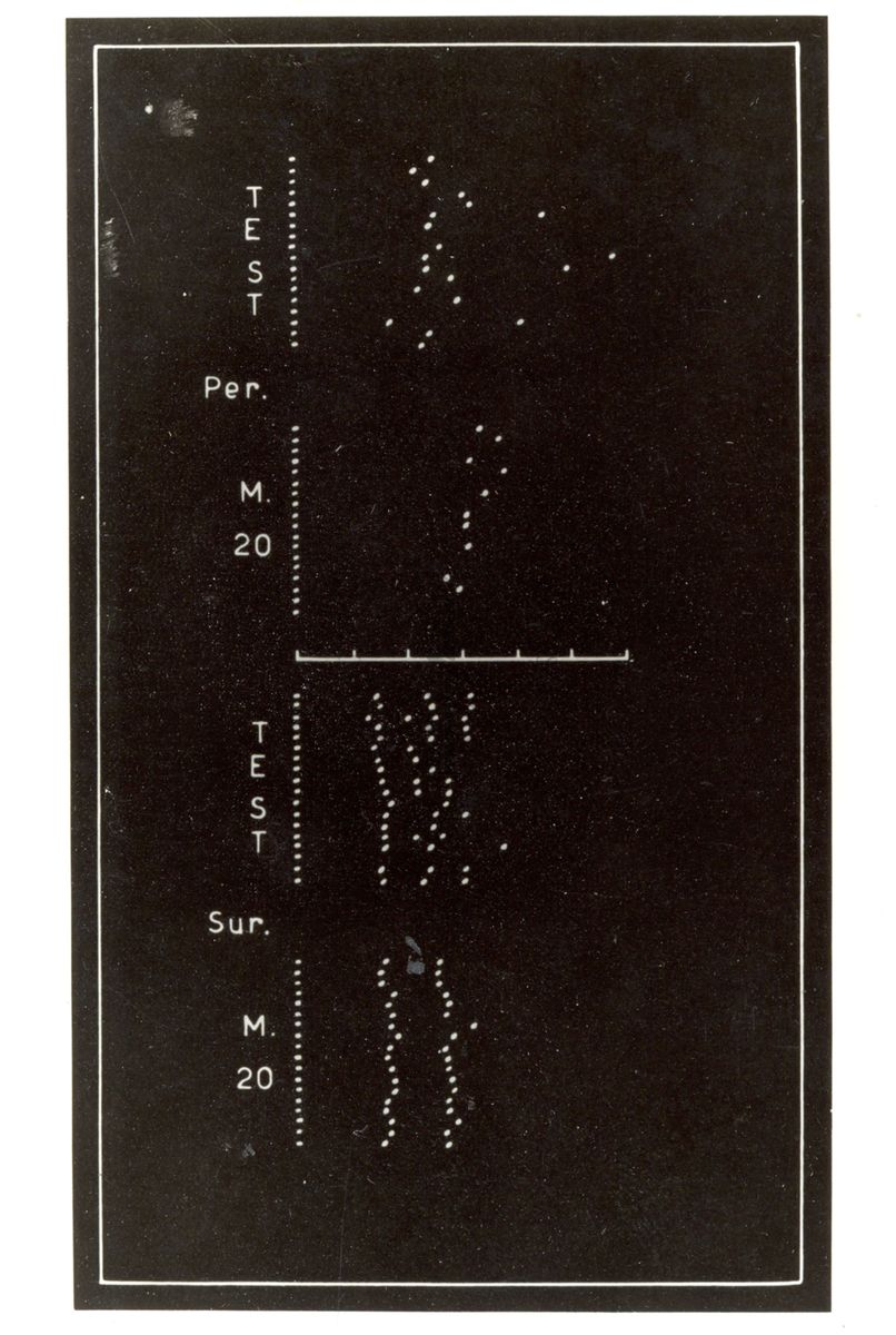 Registrazione dell'attività spontanea di singole cellule a livello del midollo spinale