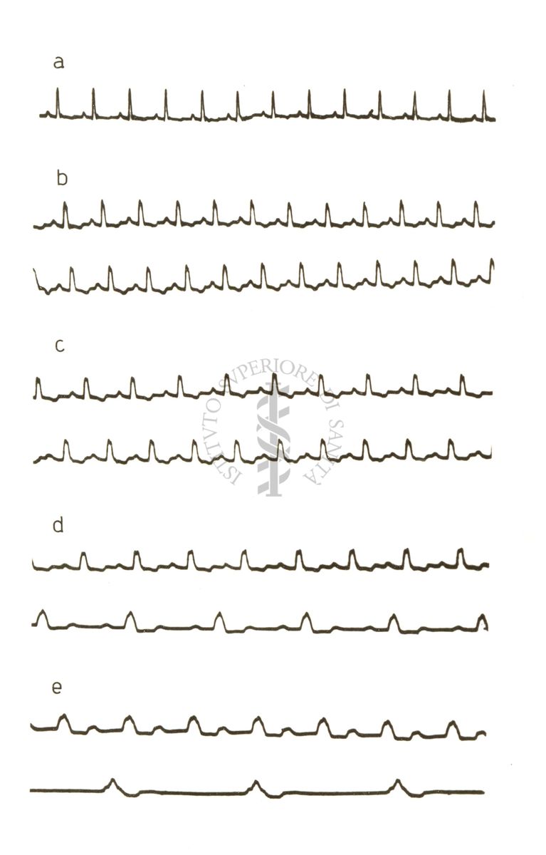 Lavoro sul 2099 I.S. - Derivato del Bispidoli Cardio Tossico