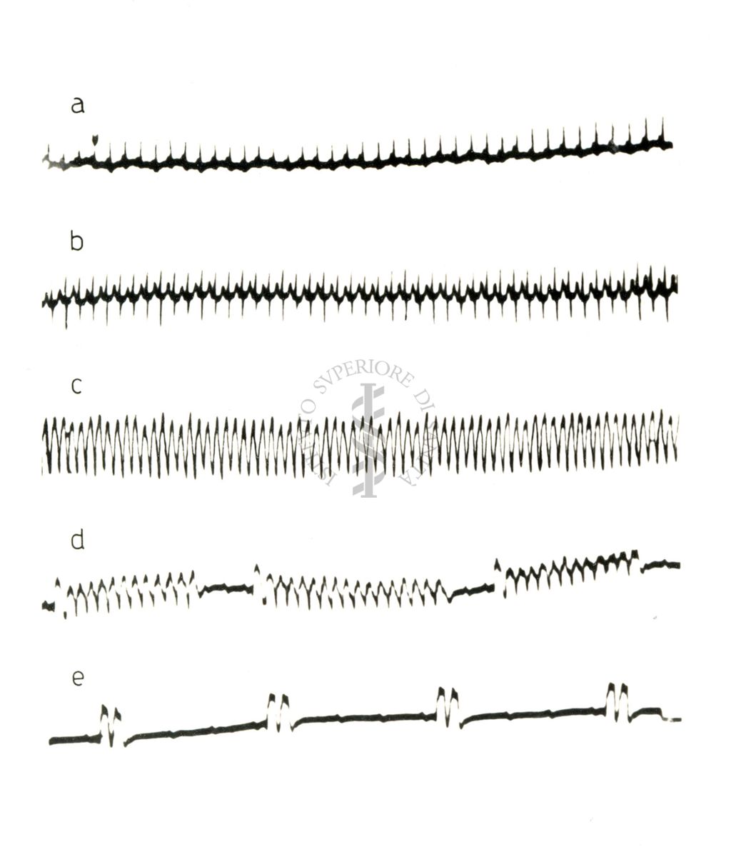 Lavoro sul 2099 I.S. - Derivato del Bispidoli Cardio Tossico