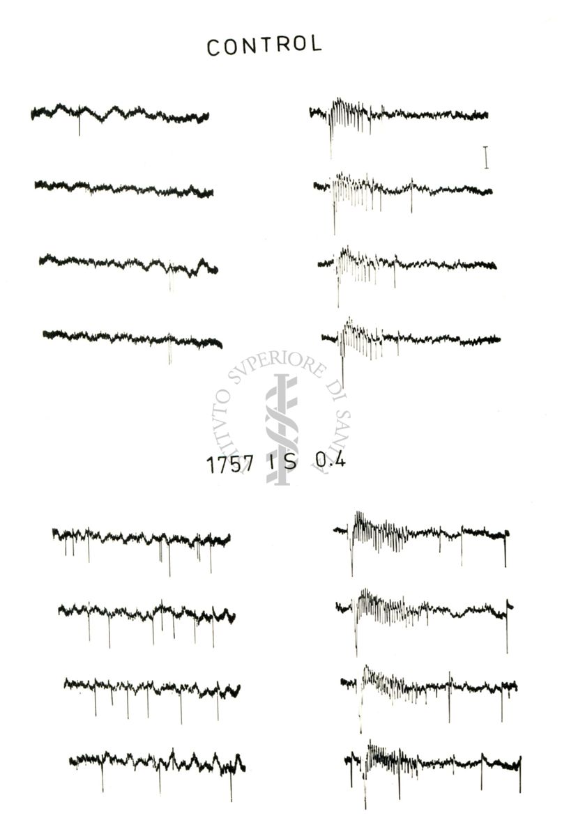 Registrazione con micro-elettrodi da singole cellule del midollo spinale