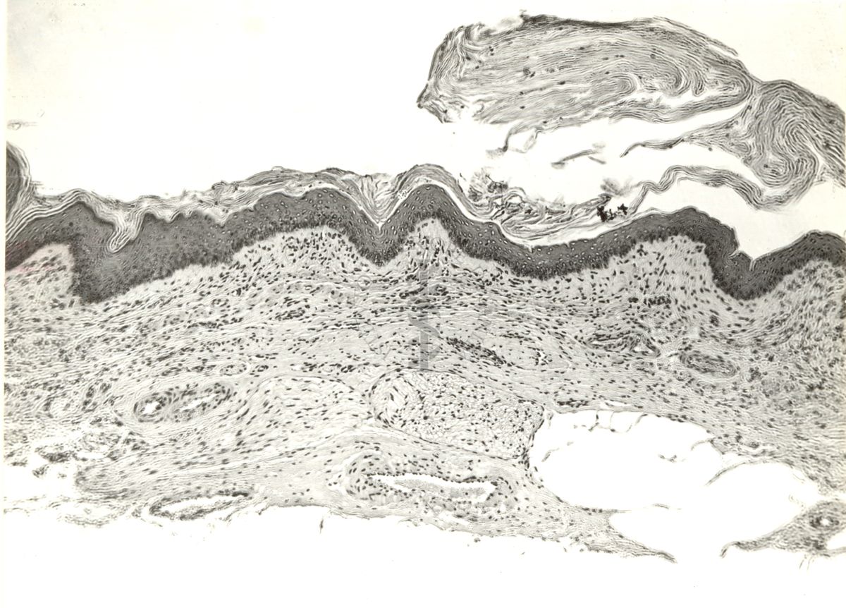 Elettroencefalogrammi di coniglio