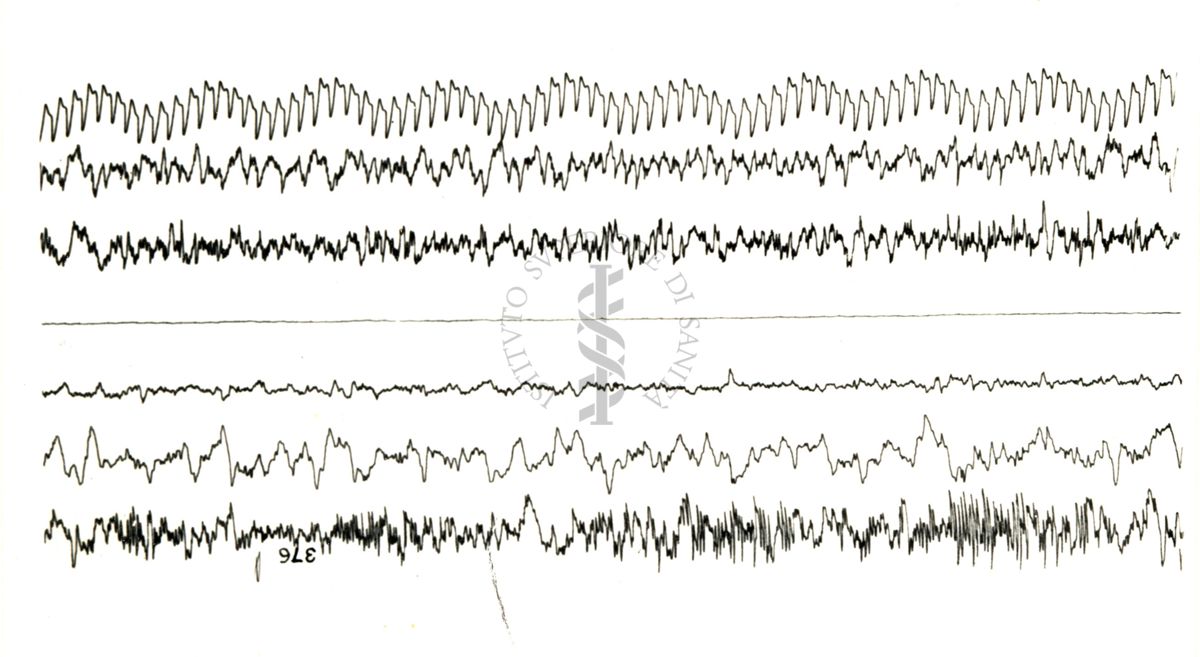 Elettroencefalogrammi di coniglio