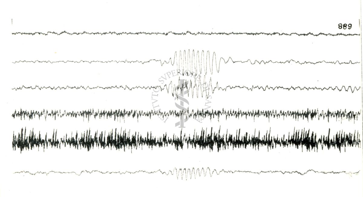 Elettroencefalogrammi di coniglio