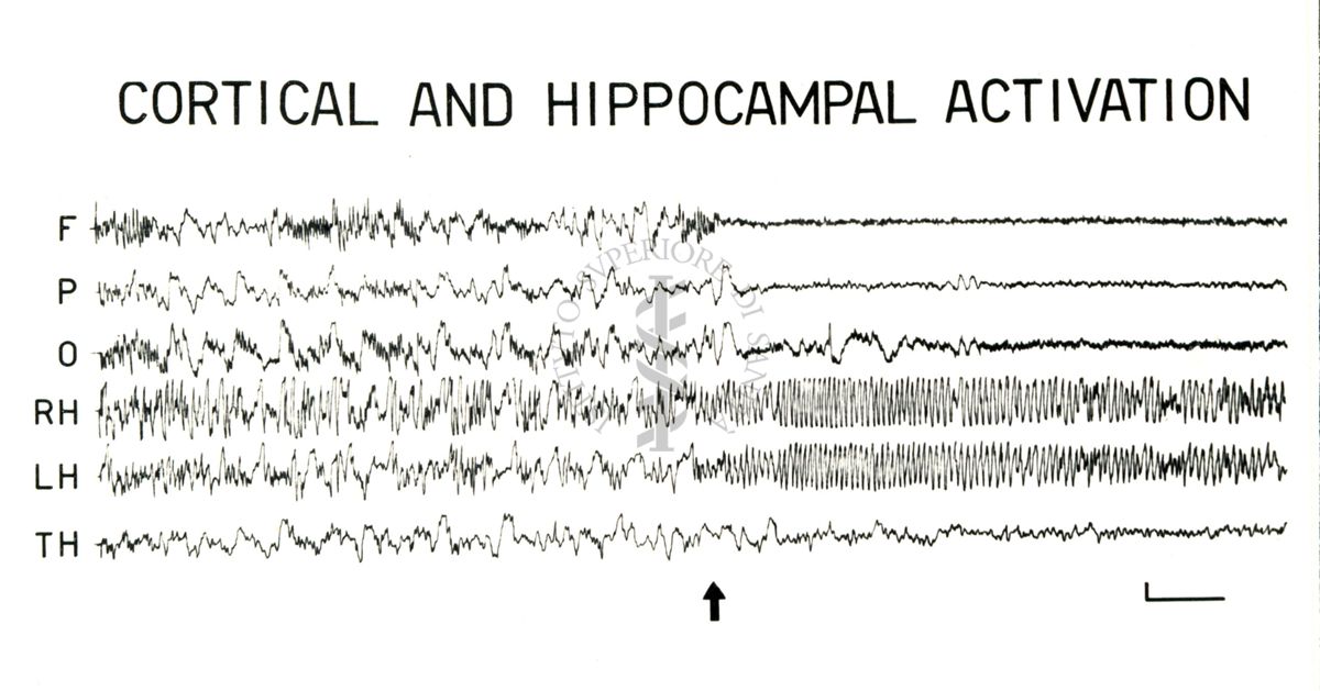 Elettroencefalogrammi di coniglio