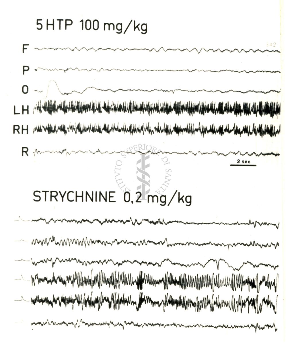 Elettroencefalogrammi di coniglio