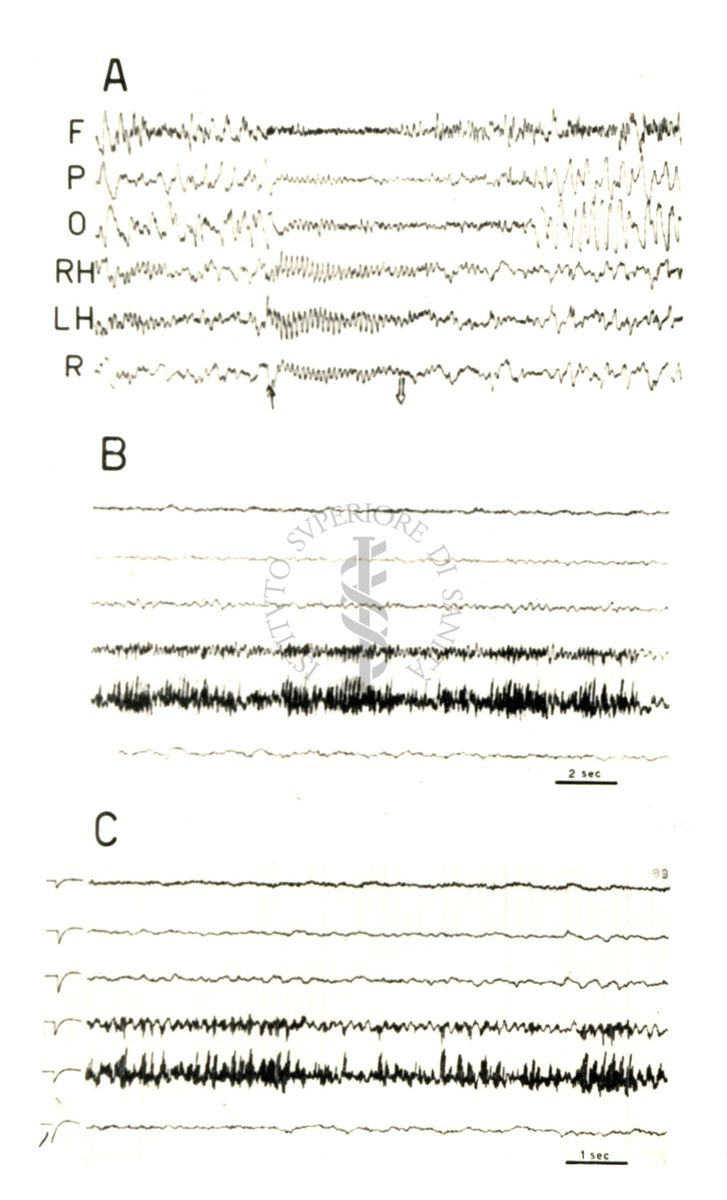 Elettroencefalogrammi di coniglio