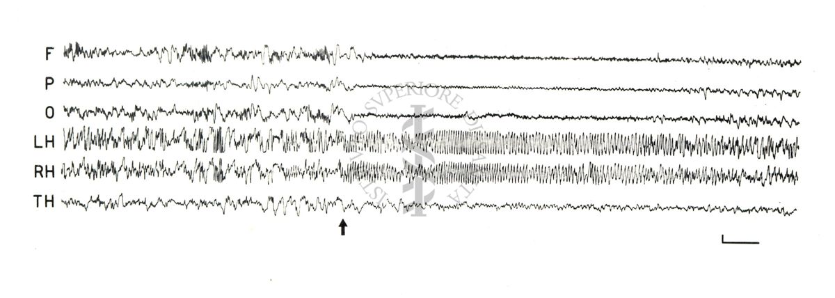 Elettroencefalogrammi di coniglio