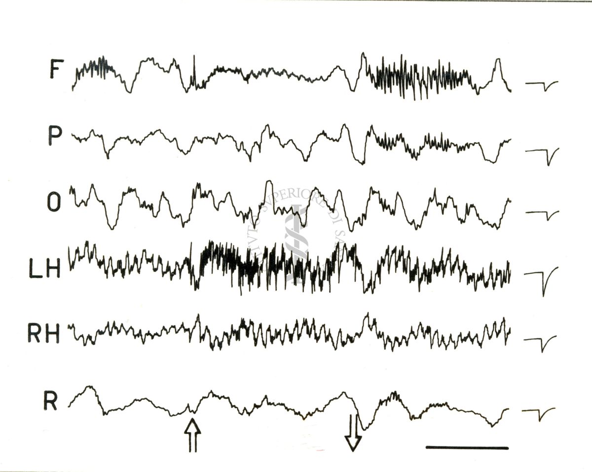 Elettroencefalogrammi di coniglio