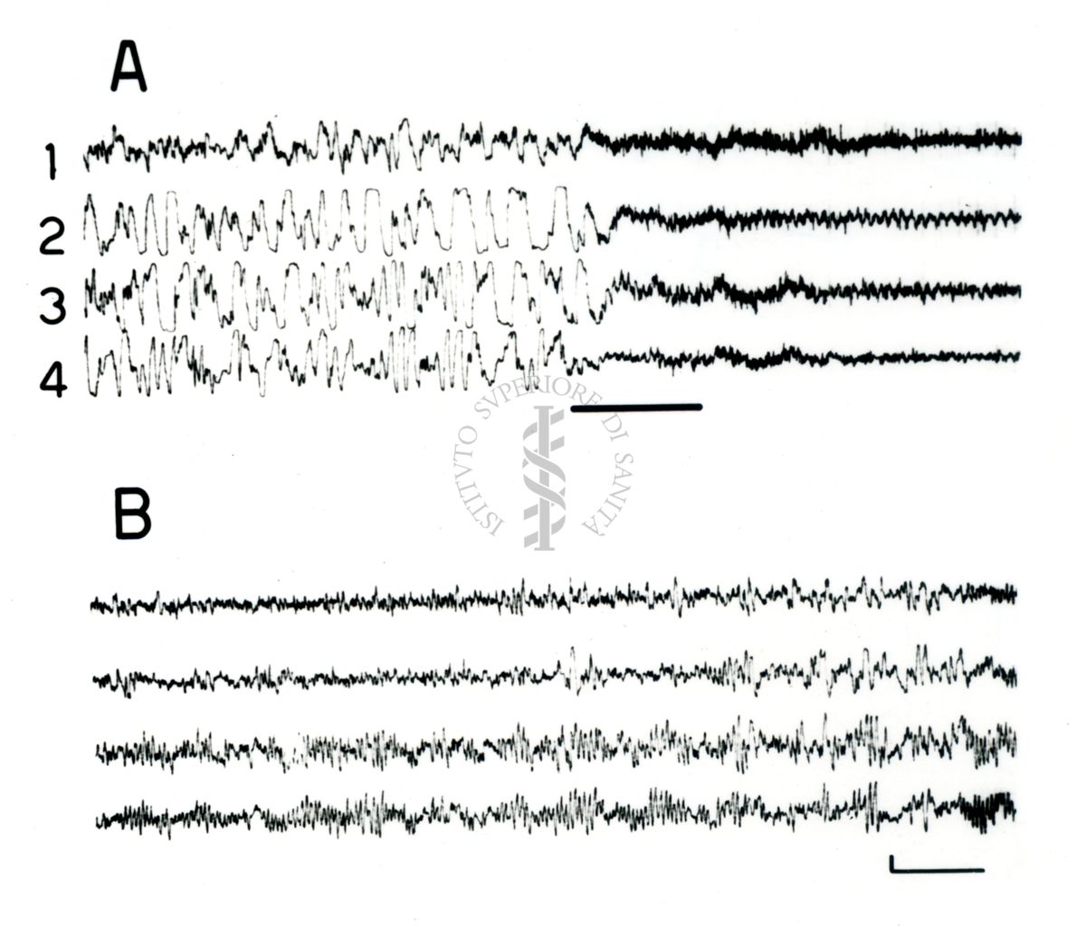 Elettroencefalogrammi di coniglio