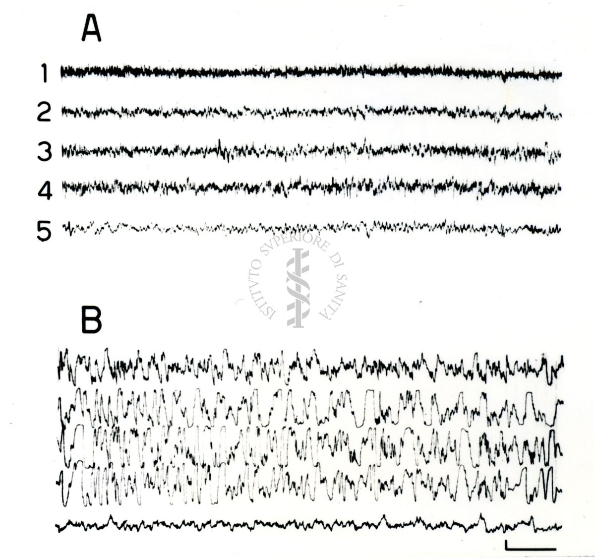 Elettroencefalogrammi di coniglio