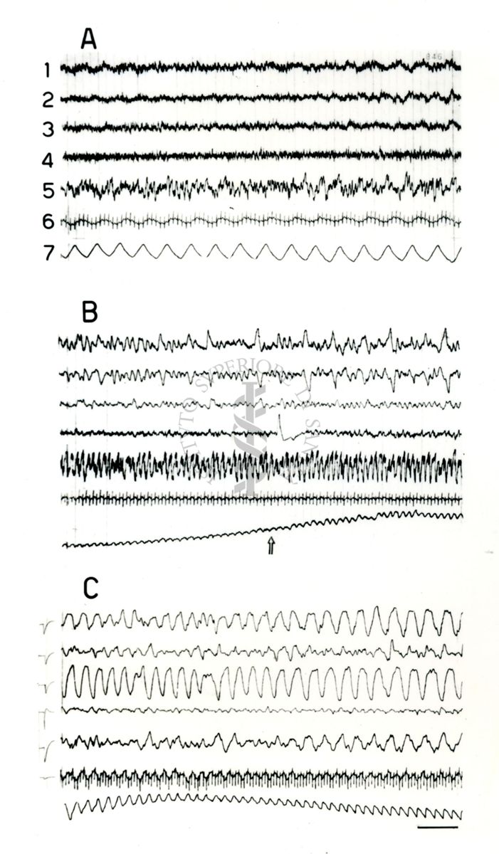 Elettroencefalogrammi di coniglio