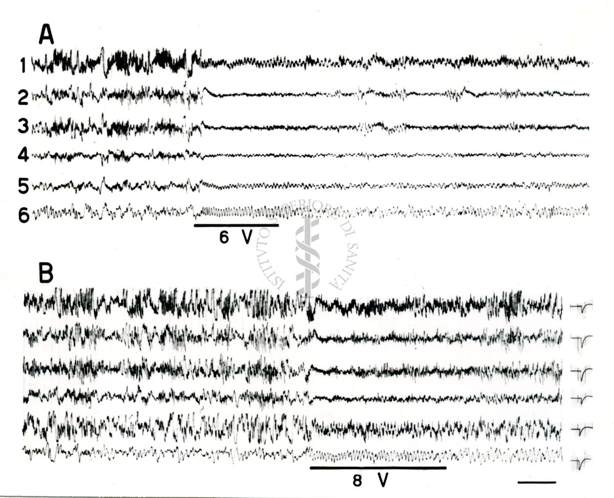 Elettroencefalogrammi di coniglio