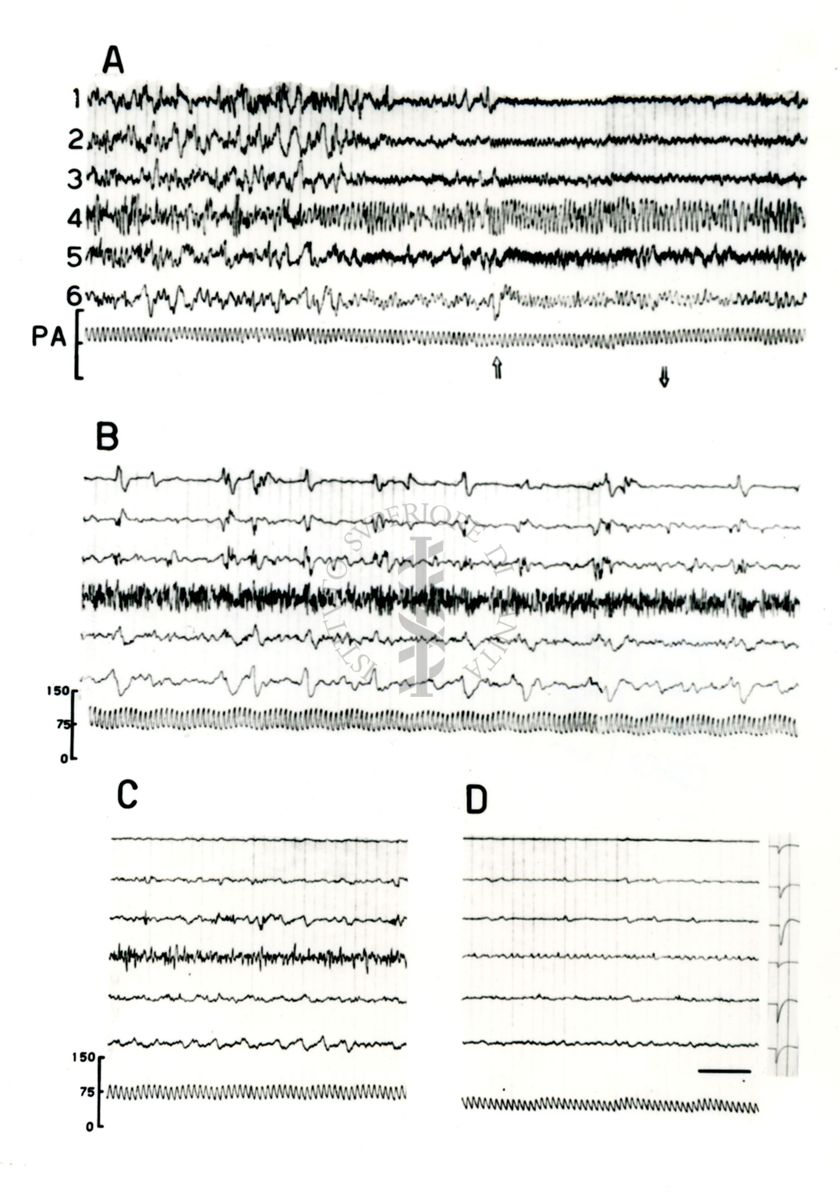 Elettroencefalogrammi di coniglio